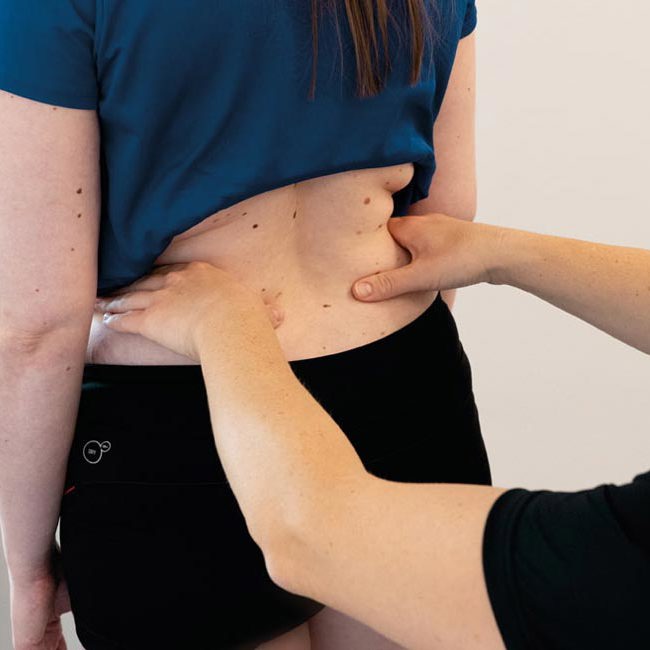 Fysioterapeut fra Aleris laver øvelser med patient for at lette patientens bækkensmerter.