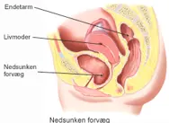 Nedsuy