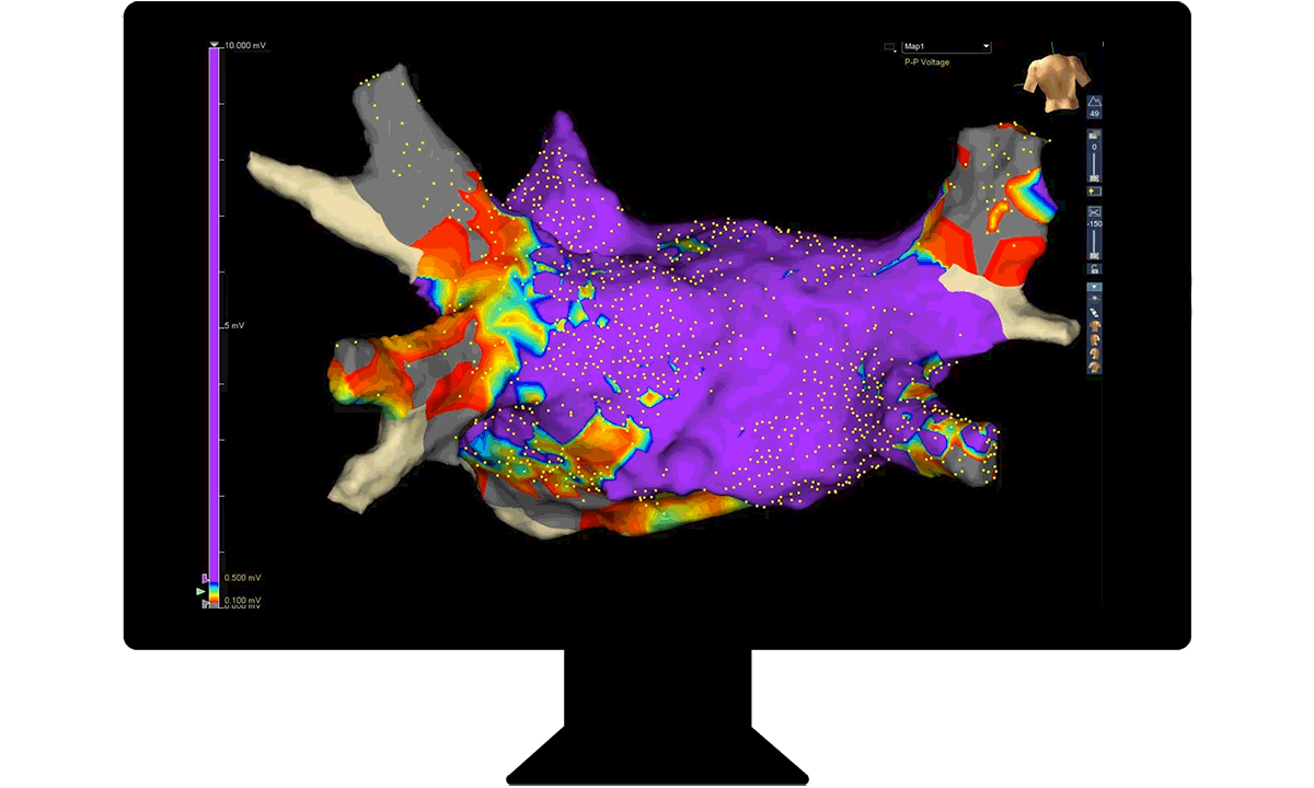 3D billede af hjertet.