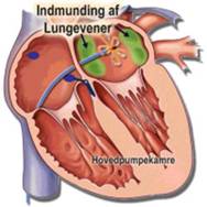 Indmunding af lungevener.
