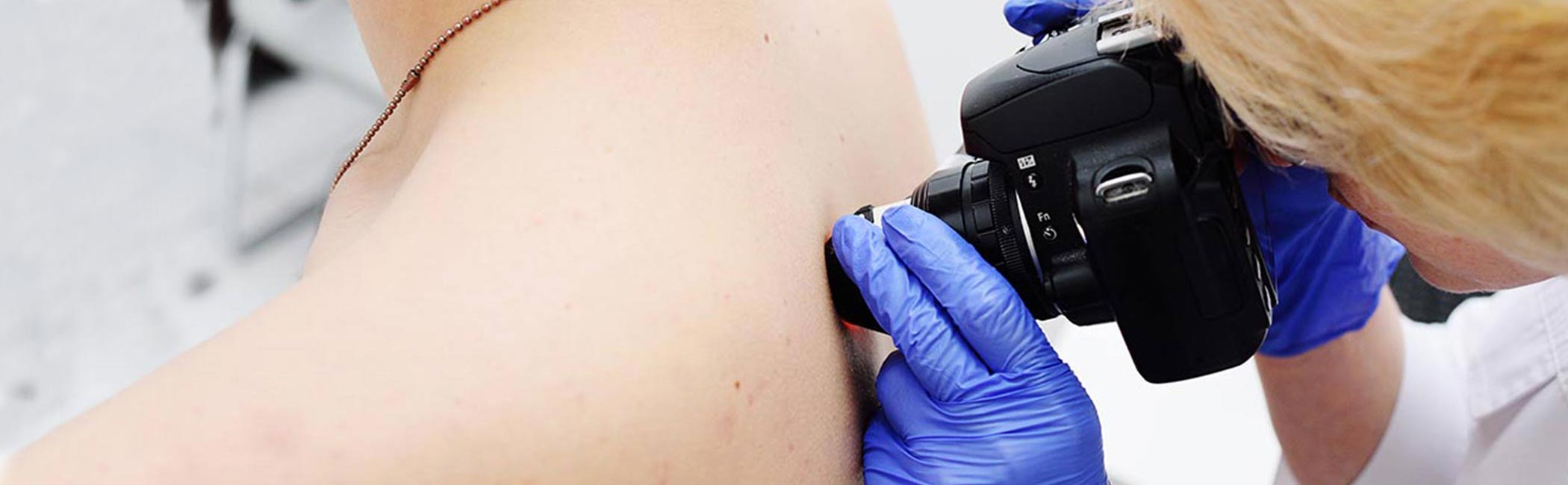 Læge udfører hudanalyse på patient.