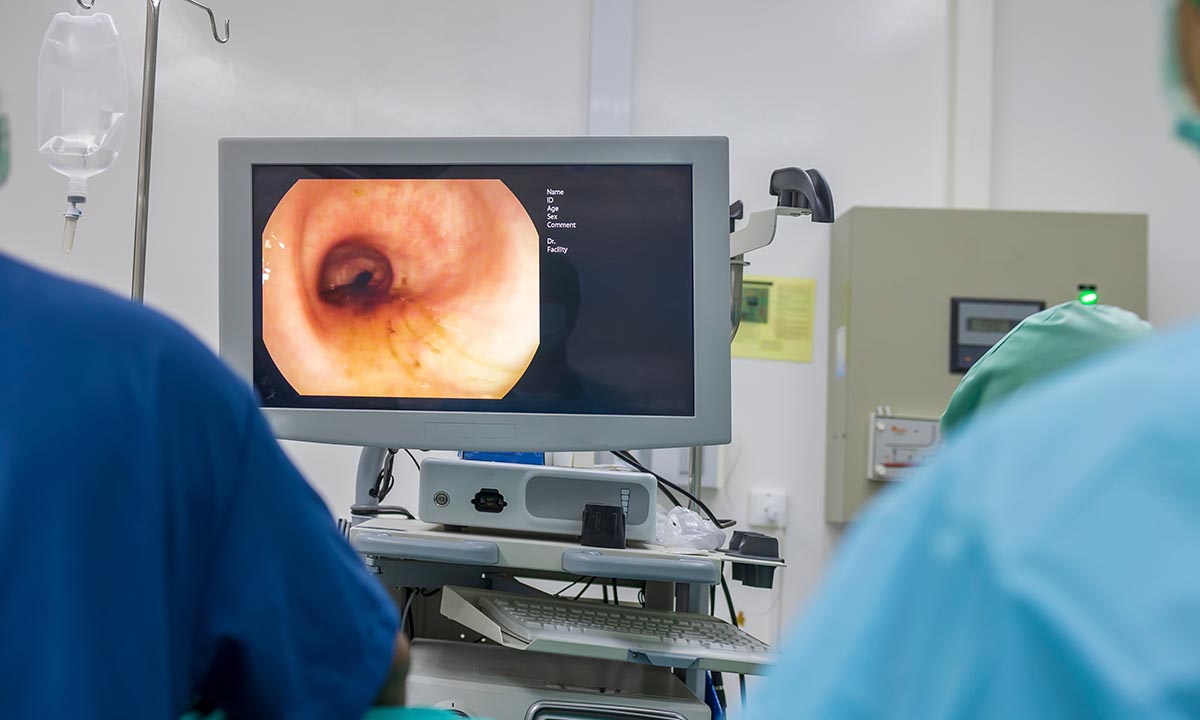 Læge foretager en koloskopi af tyktarmen.