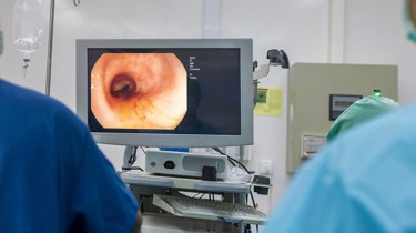 Læge foretager en koloskopi af tyktarmen.