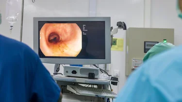 Læge foretager en koloskopi af tyktarmen.