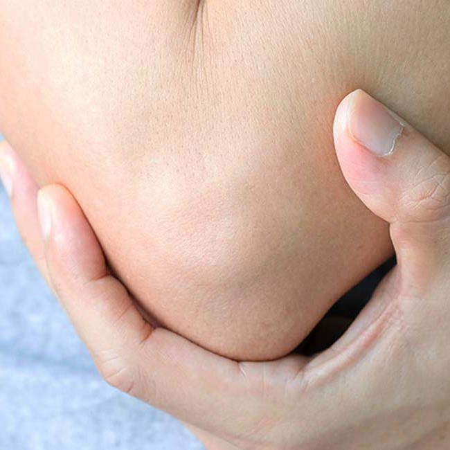 En person med albuesmerter.