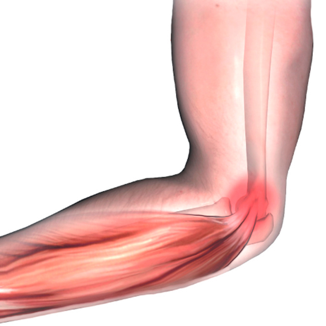 Illustration af tennisalbue.