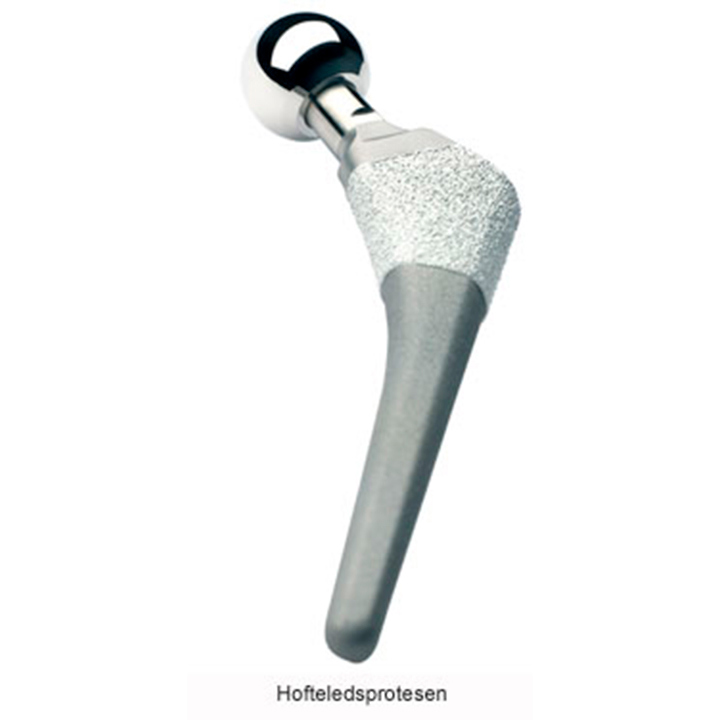 Billede af en hofteprotese.