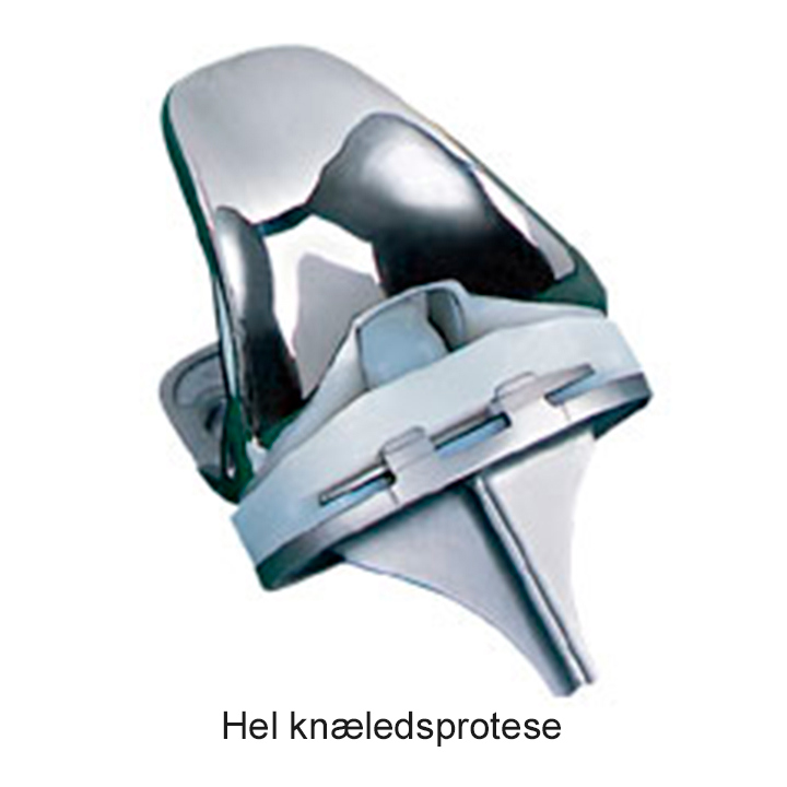 En hel knæledsprotese.