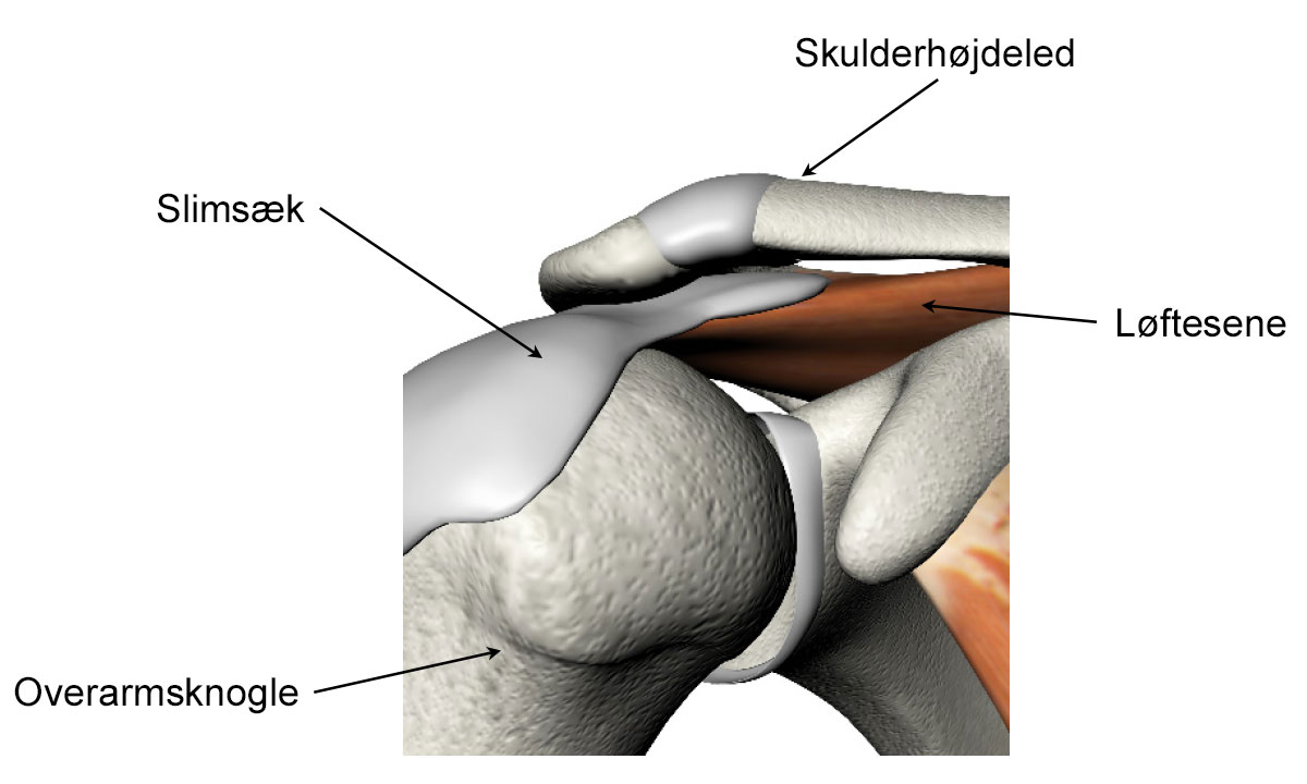 Illustration af impingement i skulder.