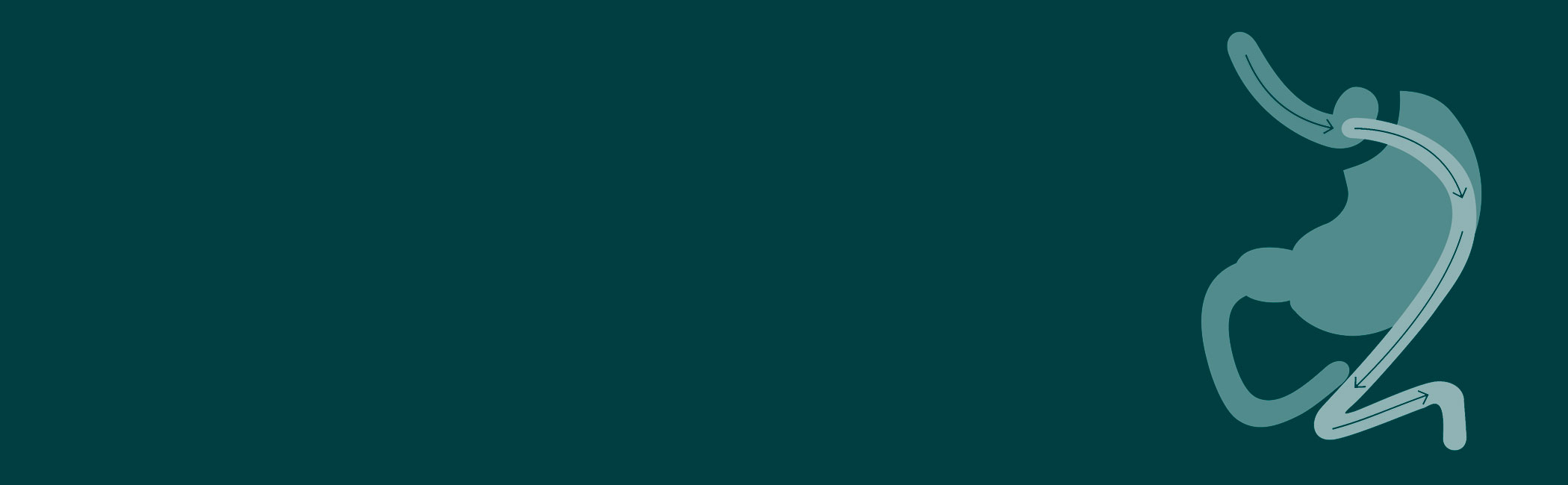 En stor illustration af gastric bypass operation.