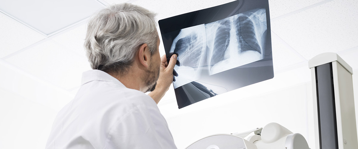 radiolog studerer røntgenbillede af brystkasse.
