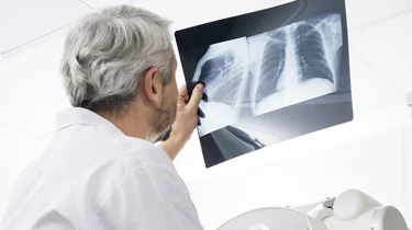 radiolog studerer røntgenbillede af brystkasse.