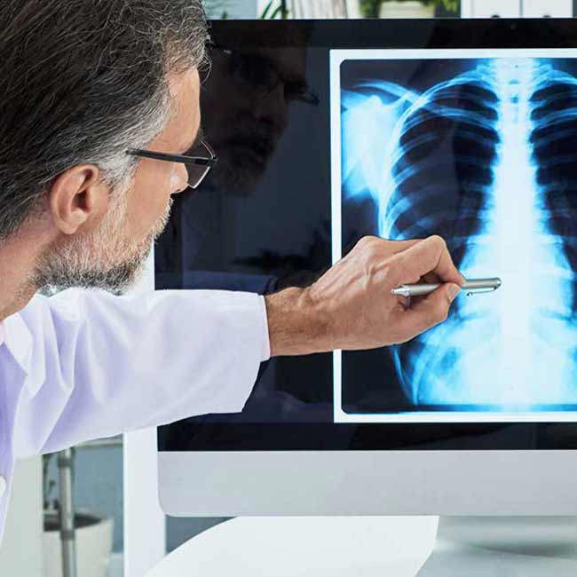radiolog forklarer røntgenbillede af brystkasse.